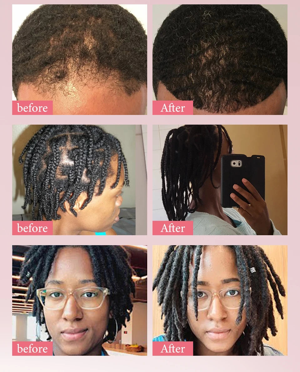 100% Unrefined Batana Hair Oil