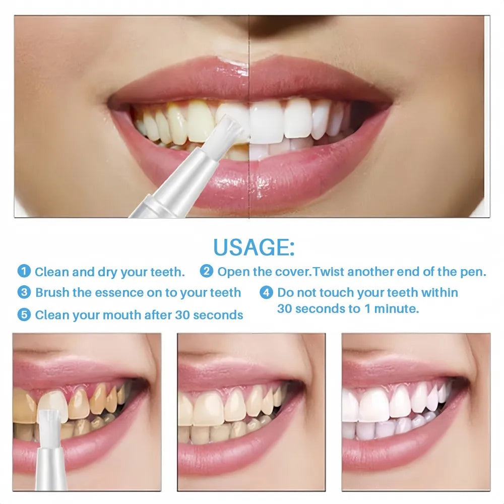 Tooth Whitening Pen with Fast Results - My Store
