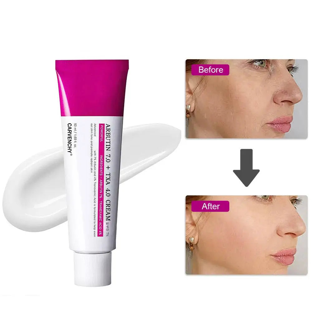 Arbutin Facial Cream - My Store