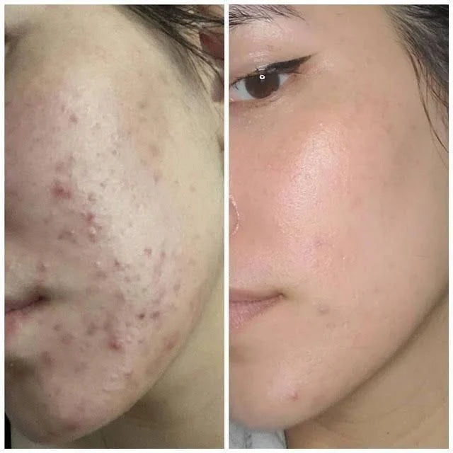 Medicube TXA Niacinamide Serum